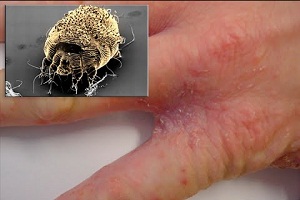  Поширюється соціальна хвороба