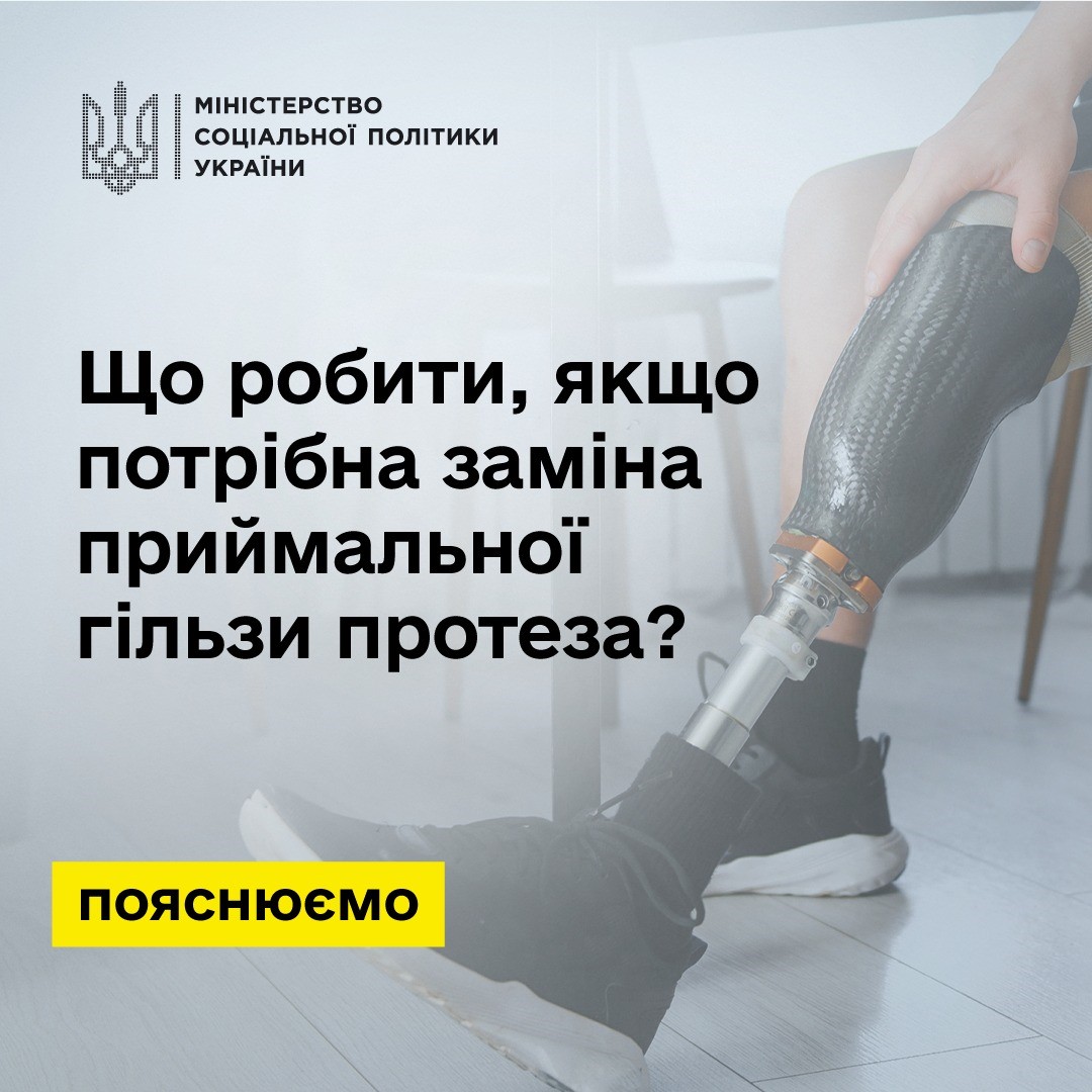Інформація для захисників: як замінити приймальну гільзу протеза за спрощеною процедурою